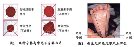 新生儿采血卡厂家解读：新生儿筛查